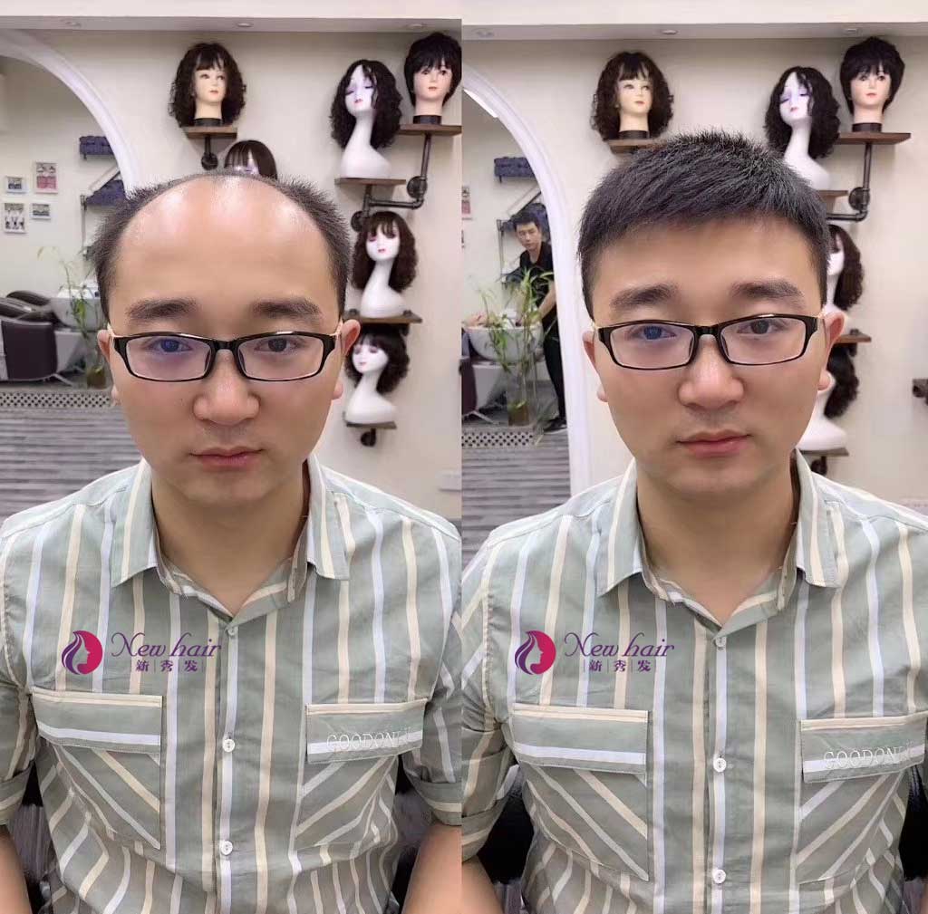 很多网友问我，为什么现在那么多人喜欢带真发做的假发？