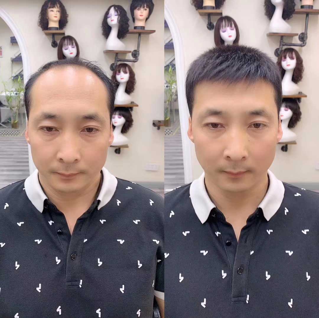 在青岛这是脱发朋友真正需要的假发片！
