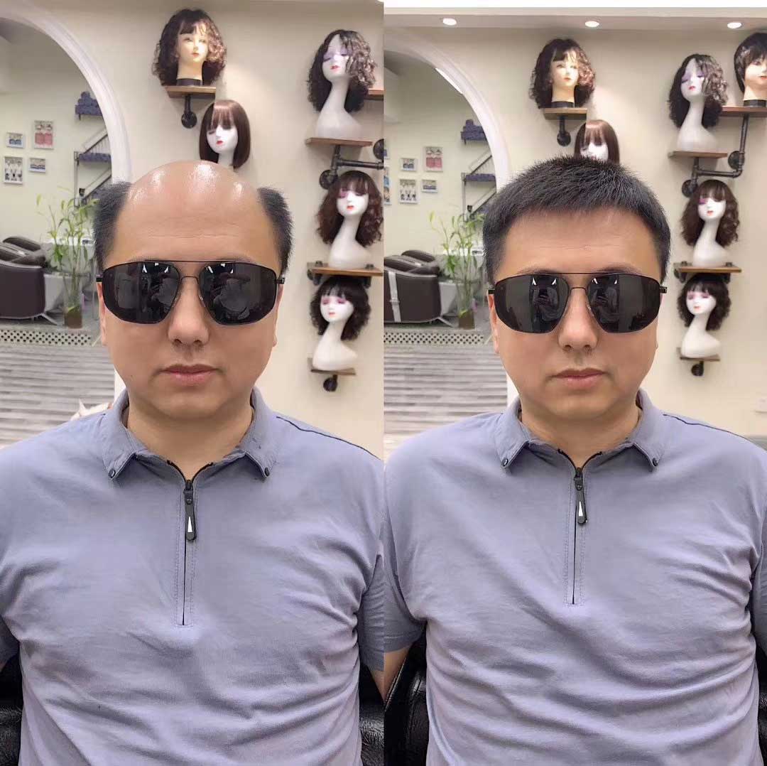 彻底解决掉发问题，这才是我要的！