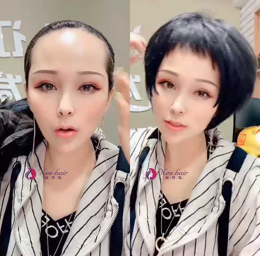 怎么佩戴假发？假发套价格怎么计算？